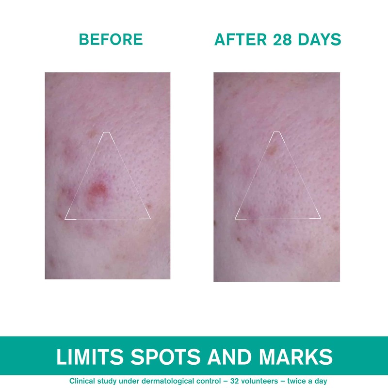 URIAGE - HYSEAC 3-REGUL+ Soin Global Anti-Imperfections - 40ml